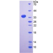 SDS-PAGE analysis of Plakophilin 2 Protein.