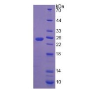 SDS-PAGE analysis of recombinant Human Interferon epsilon Protein.