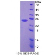 SDS-PAGE analysis of ATP Dependent DNA ligase I Protein.