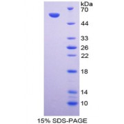 SDS-PAGE analysis of recombinant Calnexin Protein.