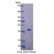 SDS-PAGE analysis of COL6A1 Protein.