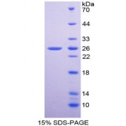SDS-PAGE analysis of recombinant Human SOD2 Protein.