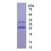 SDS-PAGE analysis of PIK3CB Protein.
