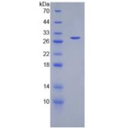 SDS-PAGE analysis of PROM1 Protein.