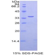 SDS-PAGE analysis of Tissue Factor Pathway Inhibitor Protein.