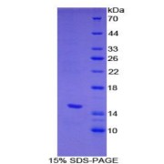SDS-PAGE analysis of Heparanase Protein.