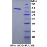 SDS-PAGE analysis of Kininogen 1 Protein.