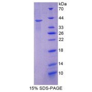 SDS-PAGE analysis of Keratin 2 Protein.