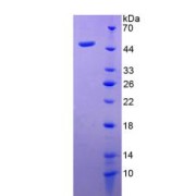 SDS-PAGE analysis of Adiponectin Protein.