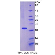 SDS-PAGE analysis of Chemerin Protein.