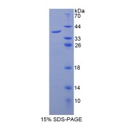 SDS-PAGE analysis of Galectin 8 Protein.