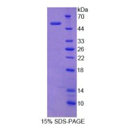 SDS-PAGE analysis of Integrin alpha X Protein.