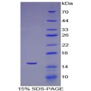 SDS-PAGE analysis of ACE Protein.