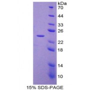 SDS-PAGE analysis of recombinant Mouse Laminin Beta 3 Protein.