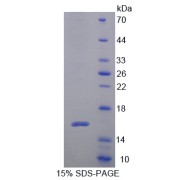 SDS-PAGE analysis of Cytospin B Protein.