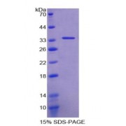 SDS-PAGE analysis of Elongin A Protein.