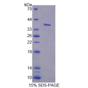 SDS-PAGE analysis of recombinant Mouse Neurocan Protein.