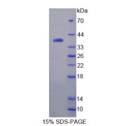 SDS-PAGE analysis of recombinant Mouse Glutaminase 2 Protein.