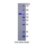 SDS-PAGE analysis of Keratocan Protein.