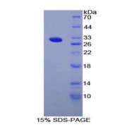 SDS-PAGE analysis of Arginyl Aminopeptidase Protein.