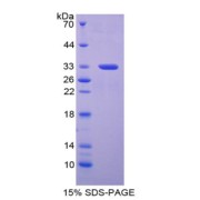 SDS-PAGE analysis of Periplakin Protein.