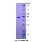 SDS-PAGE analysis of Survivin Protein.