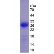 SDS-PAGE analysis of Vinculin Protein.