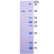 SDS-PAGE analysis of recombinant Mouse ADAM8 Protein.