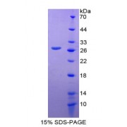 SDS-PAGE analysis of recombinant Mouse GLUD1 Protein.