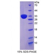 SDS-PAGE analysis of Adenylate Cyclase 1, Brain Protein.