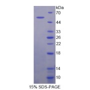SDS-PAGE analysis of recombinant Mouse CRAT Protein.