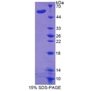 SDS-PAGE analysis of Glutamyl Aminopeptidase Protein.