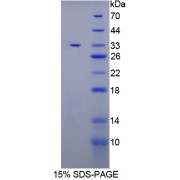 SDS-PAGE analysis of Interleukin-6 Receptor Subunit Beta Protein.