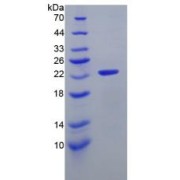 abx167415