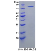 SDS-PAGE analysis of X-Ray Repair Cross Complementing 5 Protein.