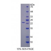 SDS-PAGE analysis of Splicing Factor 3B Subunit 3 Protein.
