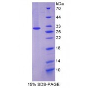 SDS-PAGE analysis of Paxillin Protein.