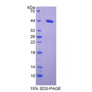 SDS-PAGE analysis of Serum Amyloid A2 Protein.