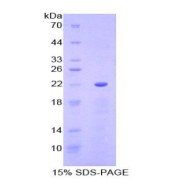 SDS-PAGE analysis of Paraoxonase 1 Protein.