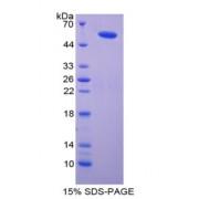 SDS-PAGE analysis of recombinant Mouse Importin 8 Protein.