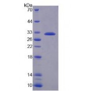 SDS-PAGE analysis of recombinant Mouse Complement Factor I Protein.