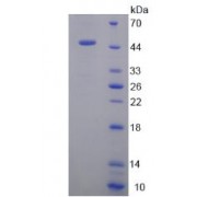 SDS-PAGE analysis of recombinant Mouse PPARA Protein.
