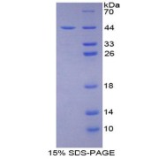 SDS-PAGE analysis of Nischarin Protein.