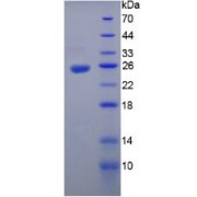 SDS-PAGE analysis of recombinant Mouse IL35 Protein.