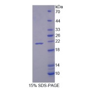 SDS-PAGE analysis of HLA Class II Histocompatibility Antigen Gamma Chain Protein.