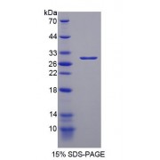 SDS-PAGE analysis of recombinant Human Poly ADP Ribose Polymerase Protein.