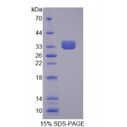 SDS-PAGE analysis of recombinant Pig Complement C3 Protein.