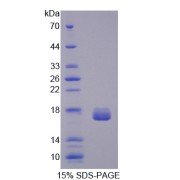 SDS-PAGE analysis of Galectin 2 Protein.