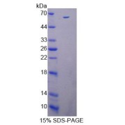SDS-PAGE analysis of IL12B Protein.