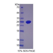 SDS-PAGE analysis of Ciliary Neurotrophic Factor Protein.